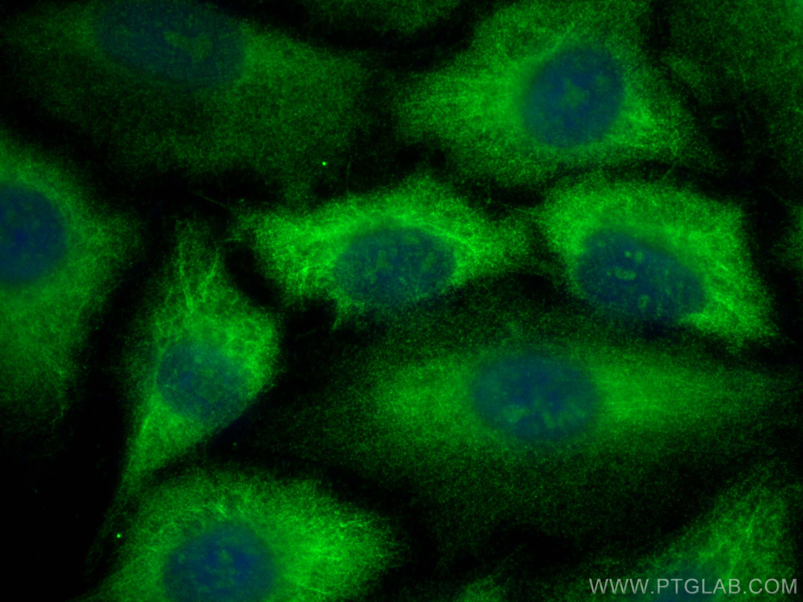 IF Staining of A549 using 19122-1-AP