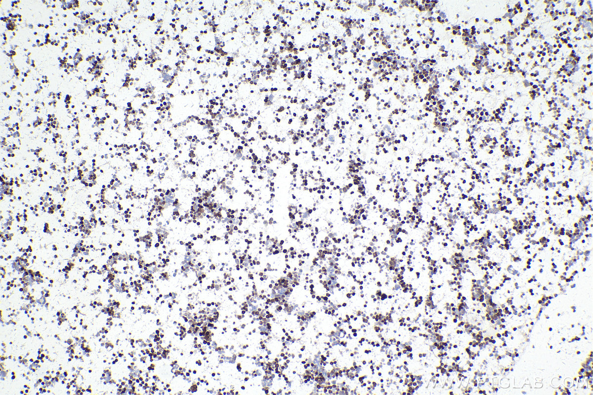 IHC staining of MJ using 68803-2-Ig