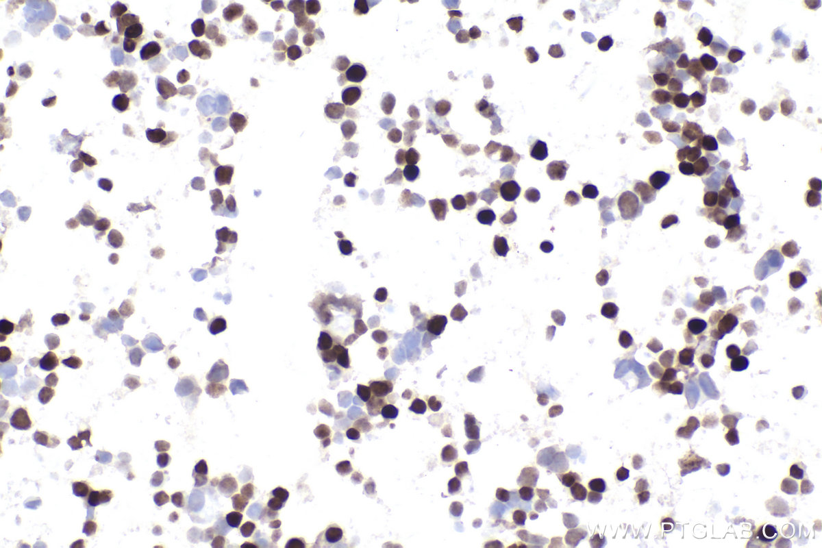 IHC staining of MJ using 68803-2-Ig