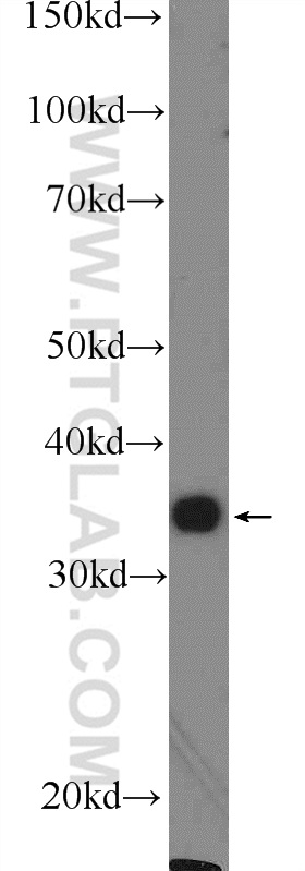 WB analysis of mouse liver using 16234-1-AP