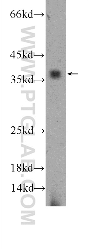 WB analysis of mouse colon using 24937-1-AP