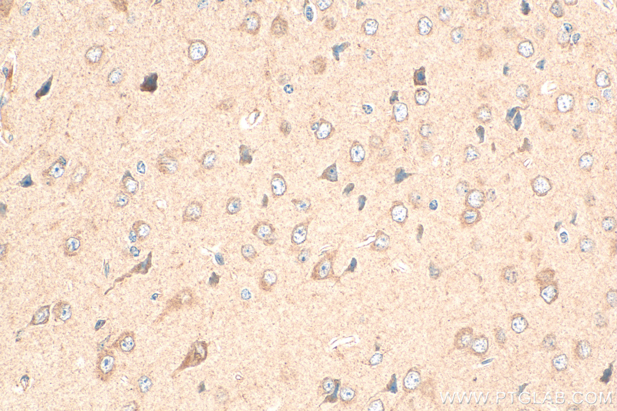 IHC staining of mouse brain using 30989-1-AP