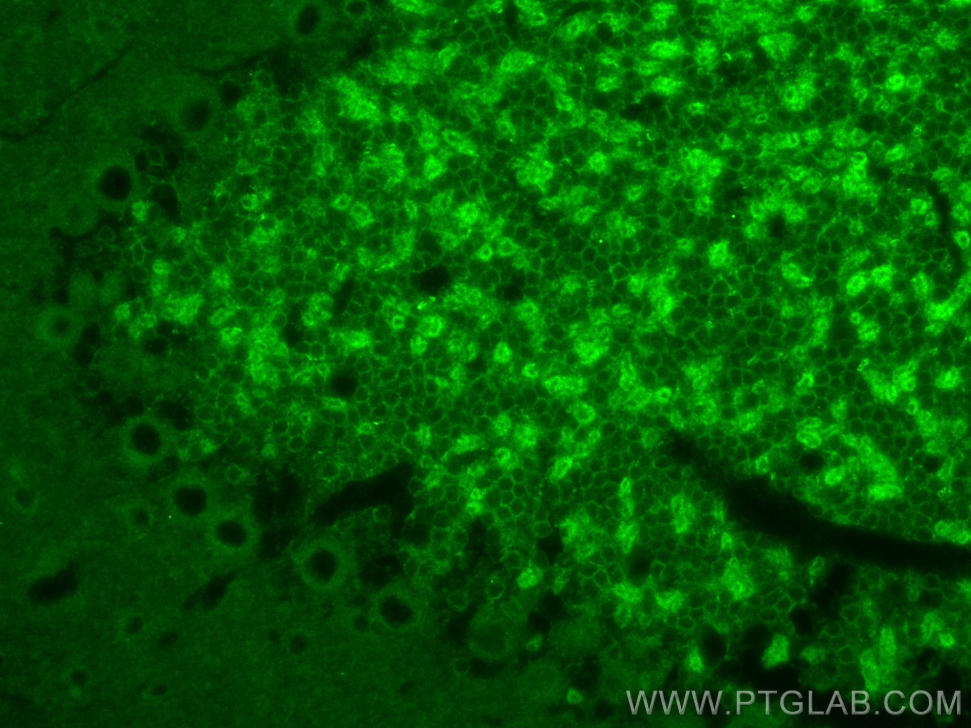 IF Staining of mouse cerebellum using 10506-2-AP