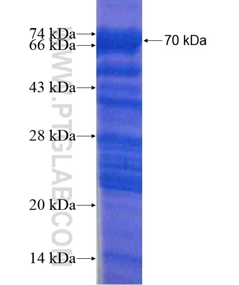FRMPD4 fusion protein Ag21050 SDS-PAGE
