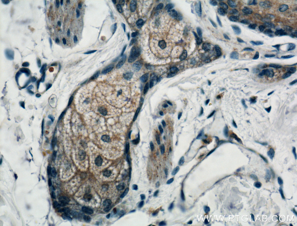 IHC staining of human skin using 12249-1-AP