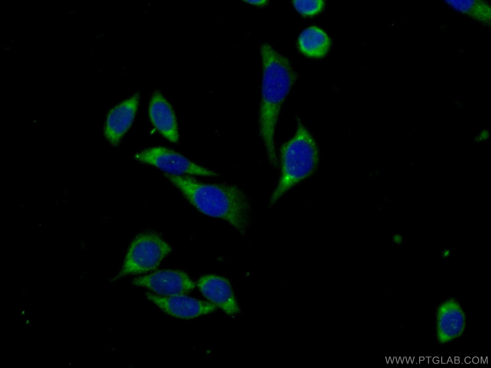 IF Staining of PC-3 using 13536-1-AP