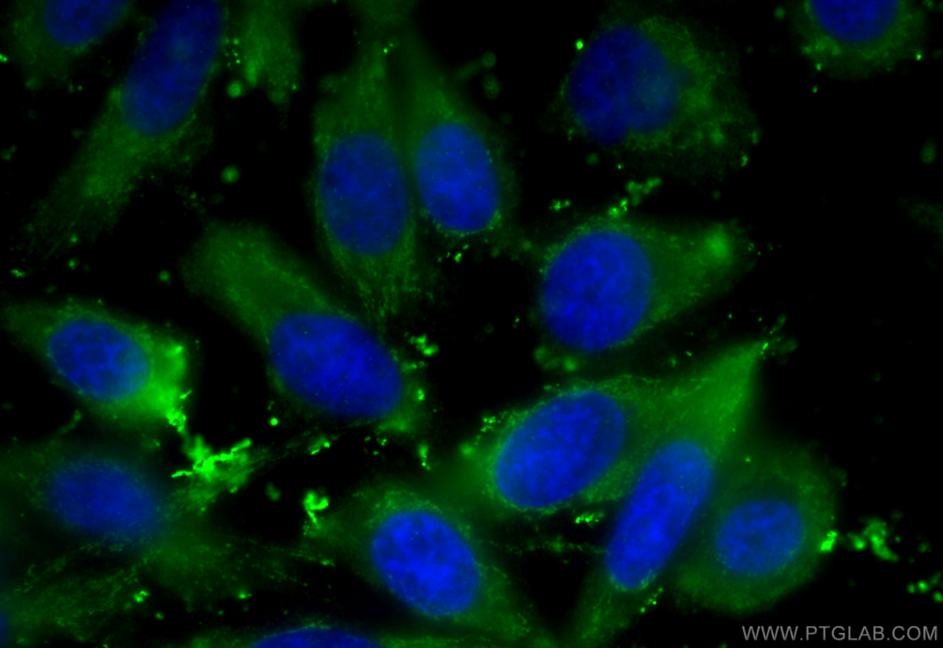 IF Staining of PC-3 using 13536-1-AP