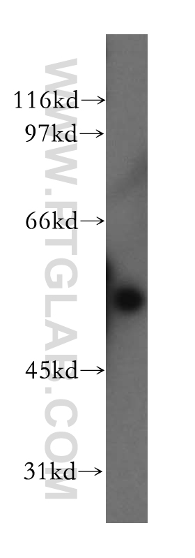 WB analysis of PC-3 using 13536-1-AP