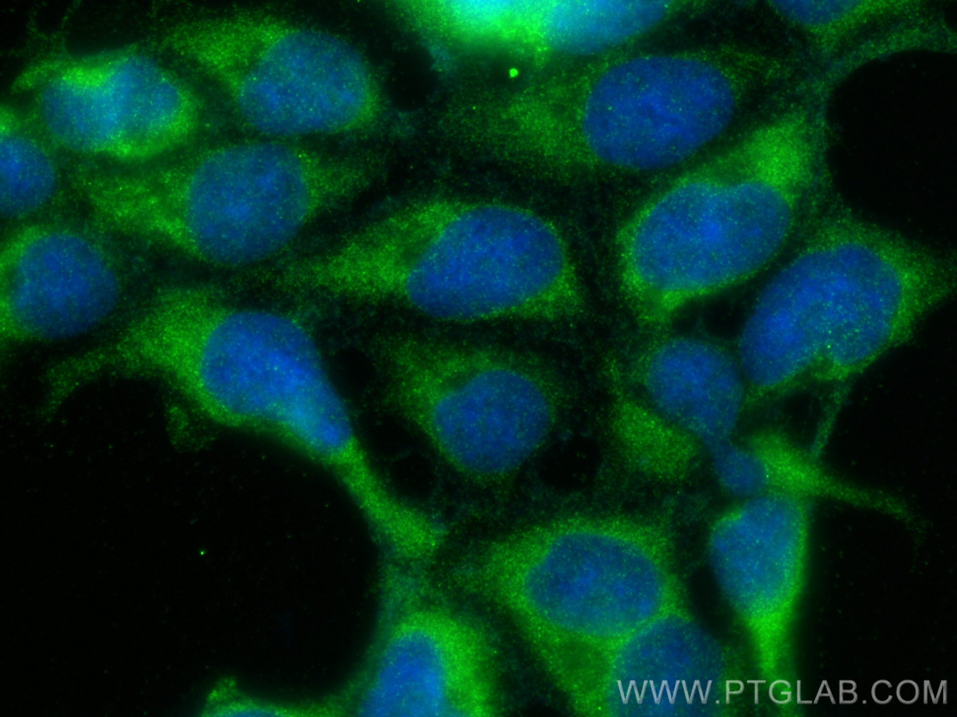 IF Staining of HEK-293 using 21032-1-AP