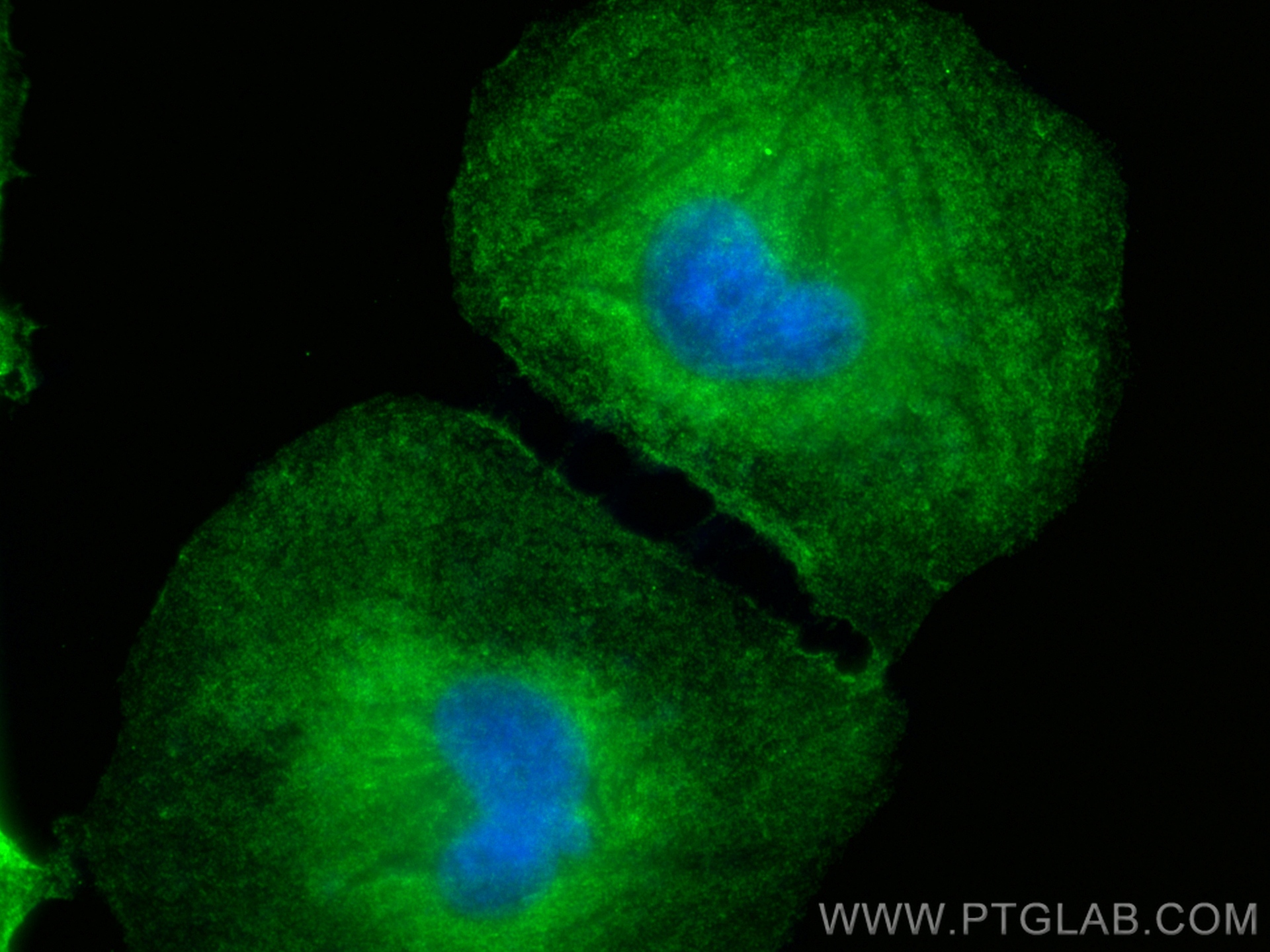 IF Staining of HeLa using 21032-1-AP