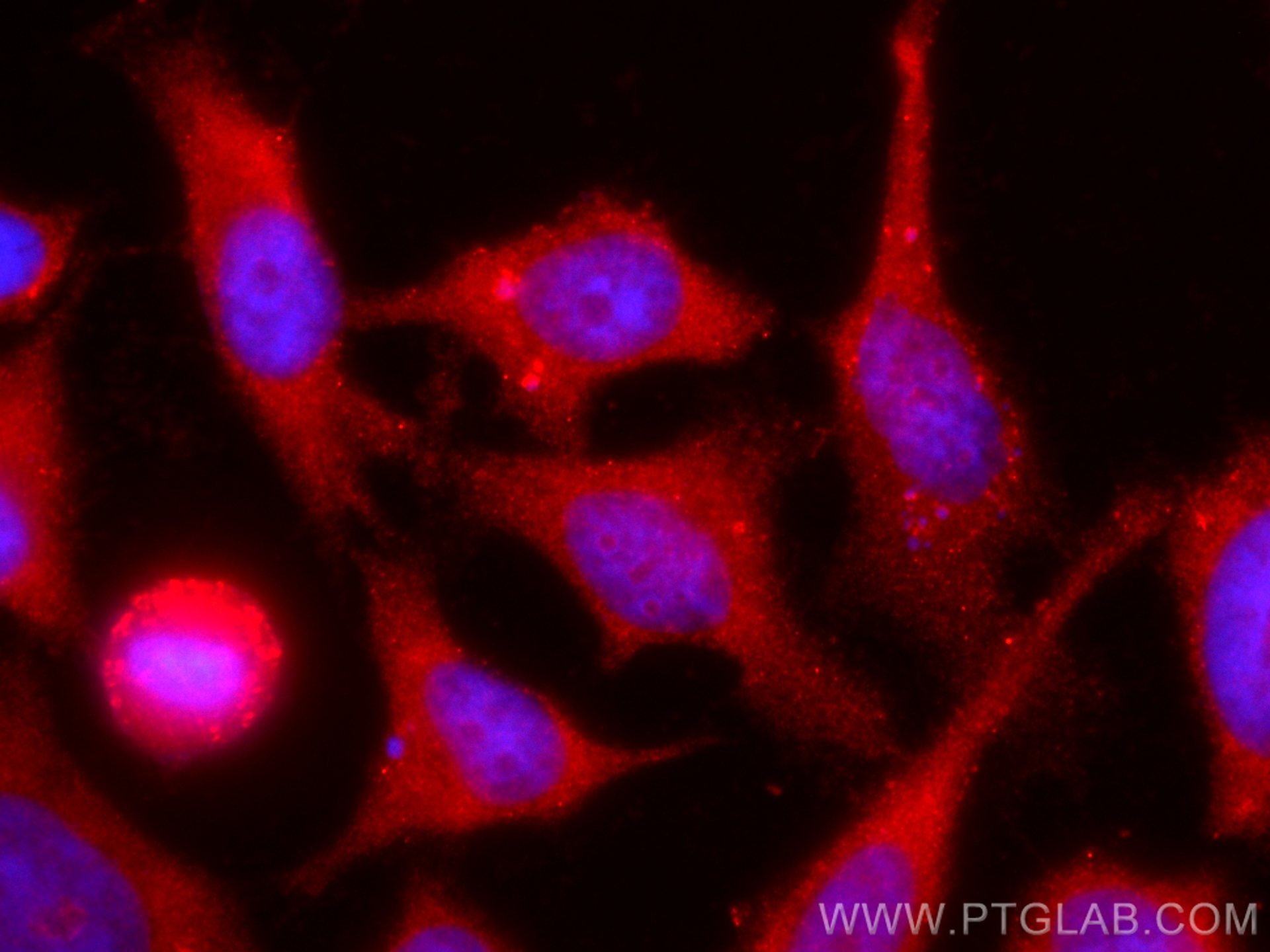 IF Staining of HeLa using CL594-22665