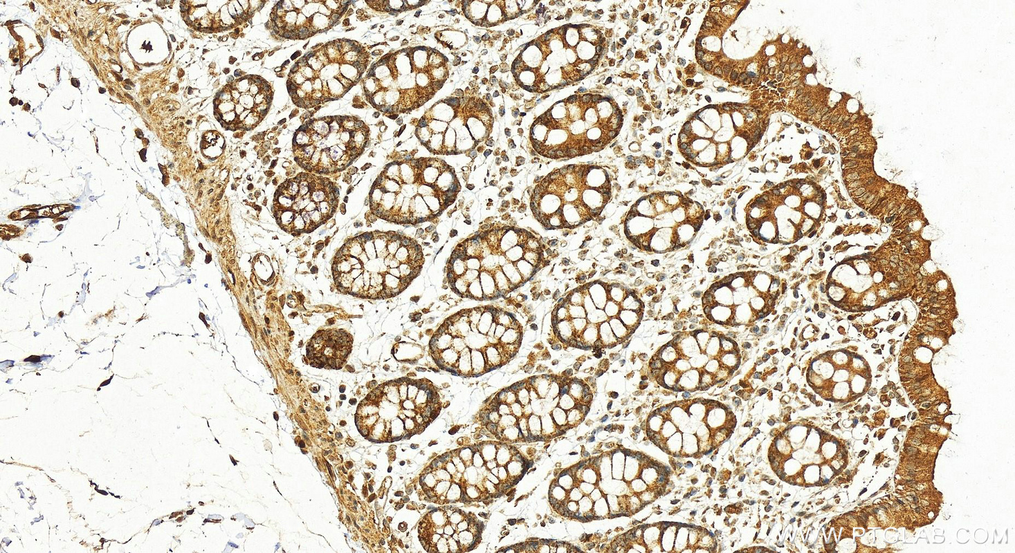 IHC staining of human colon using 20182-1-AP