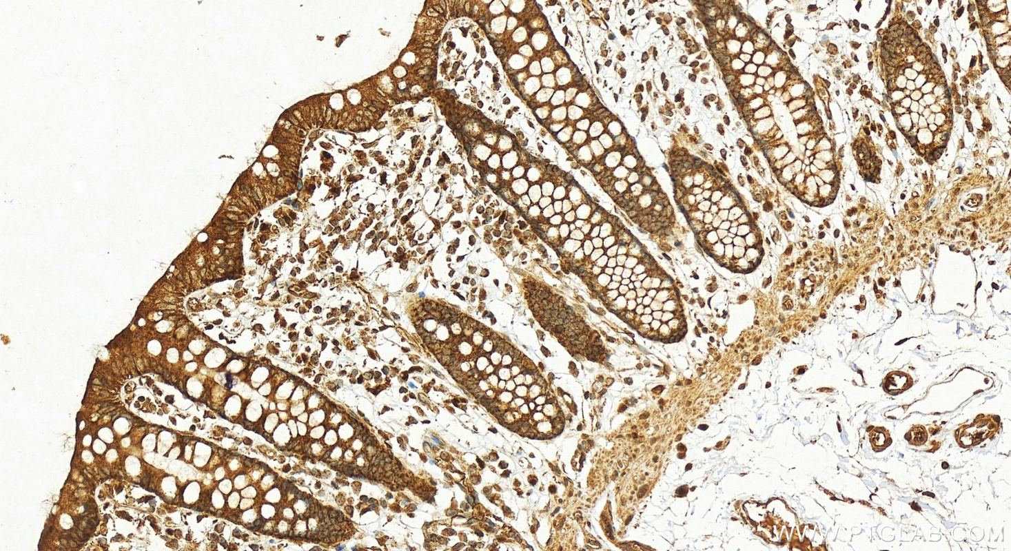 IHC staining of human colon using 20182-1-AP