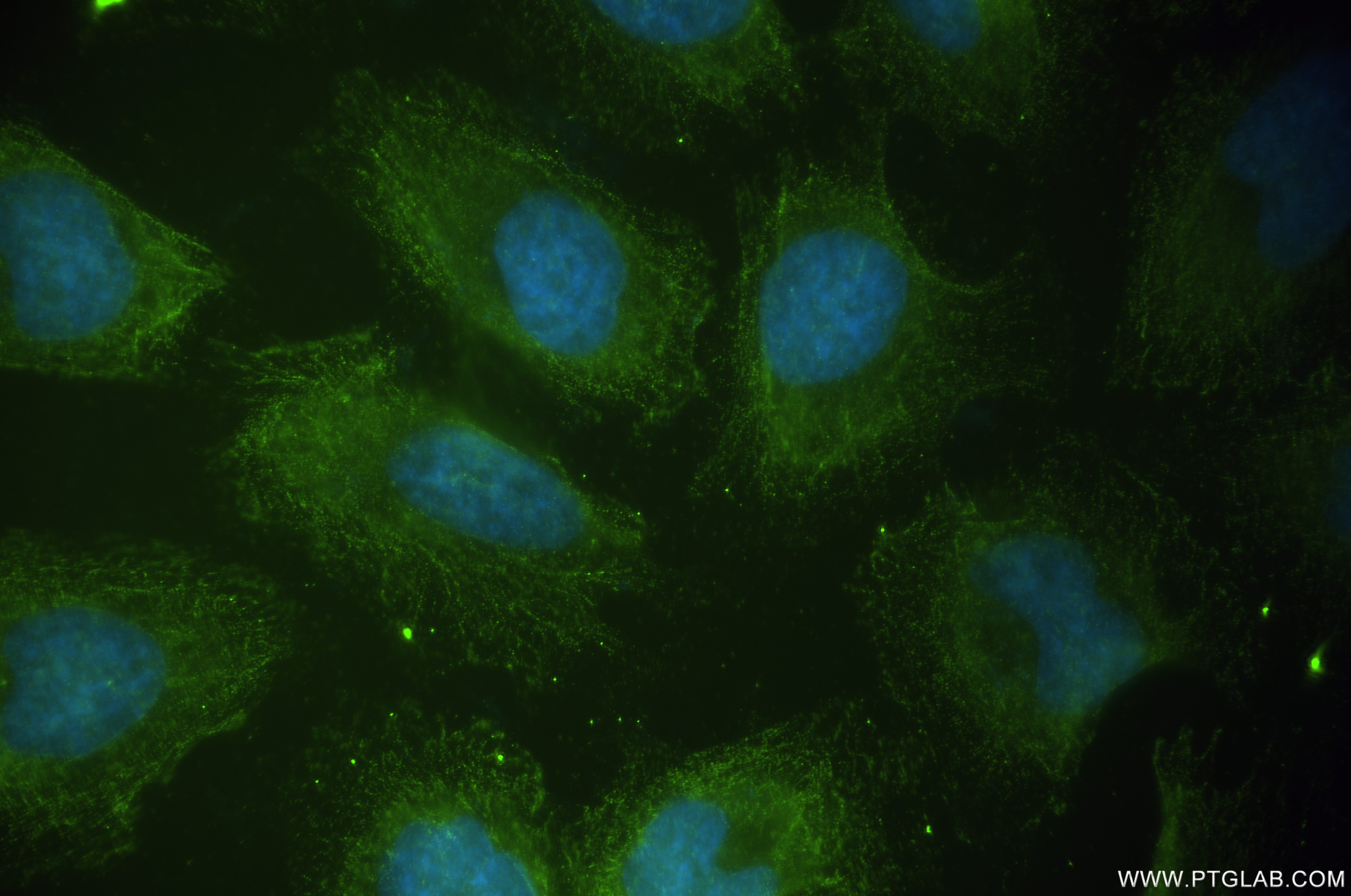 IF Staining of HeLa using 84672-2-RR