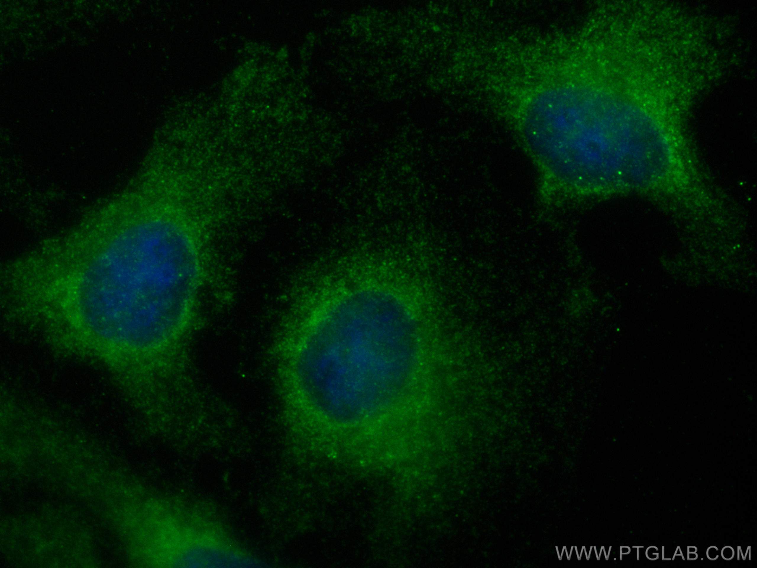 IF Staining of HeLa using 11682-1-AP