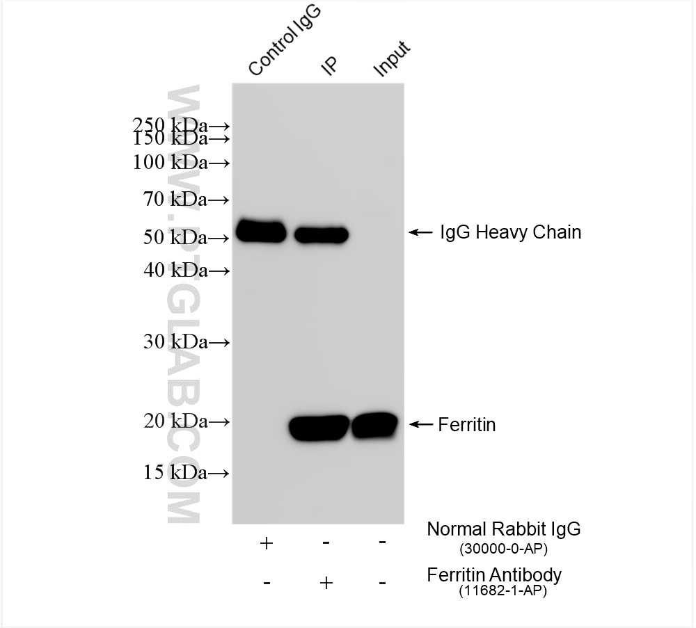 IP experiment of HeLa using 11682-1-AP