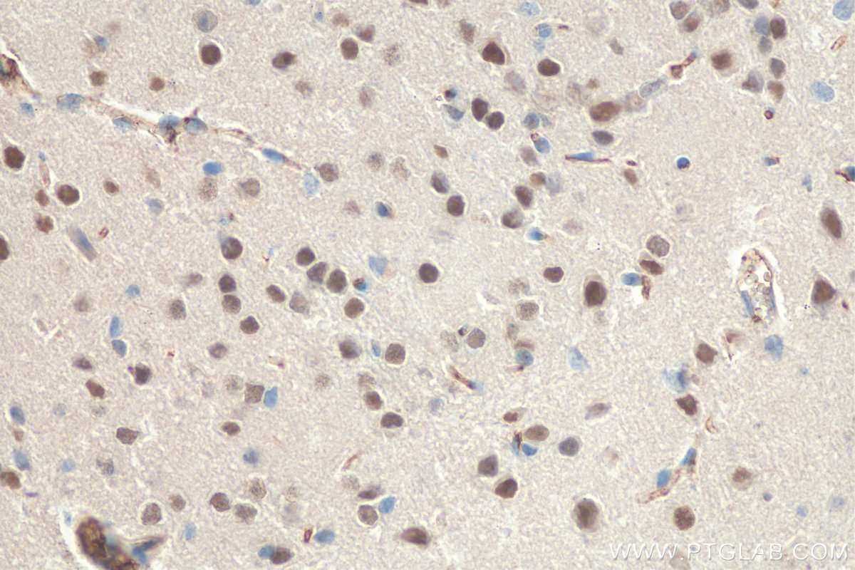 IHC staining of mouse brain using 68111-1-Ig (same clone as 68111-1-PBS)
