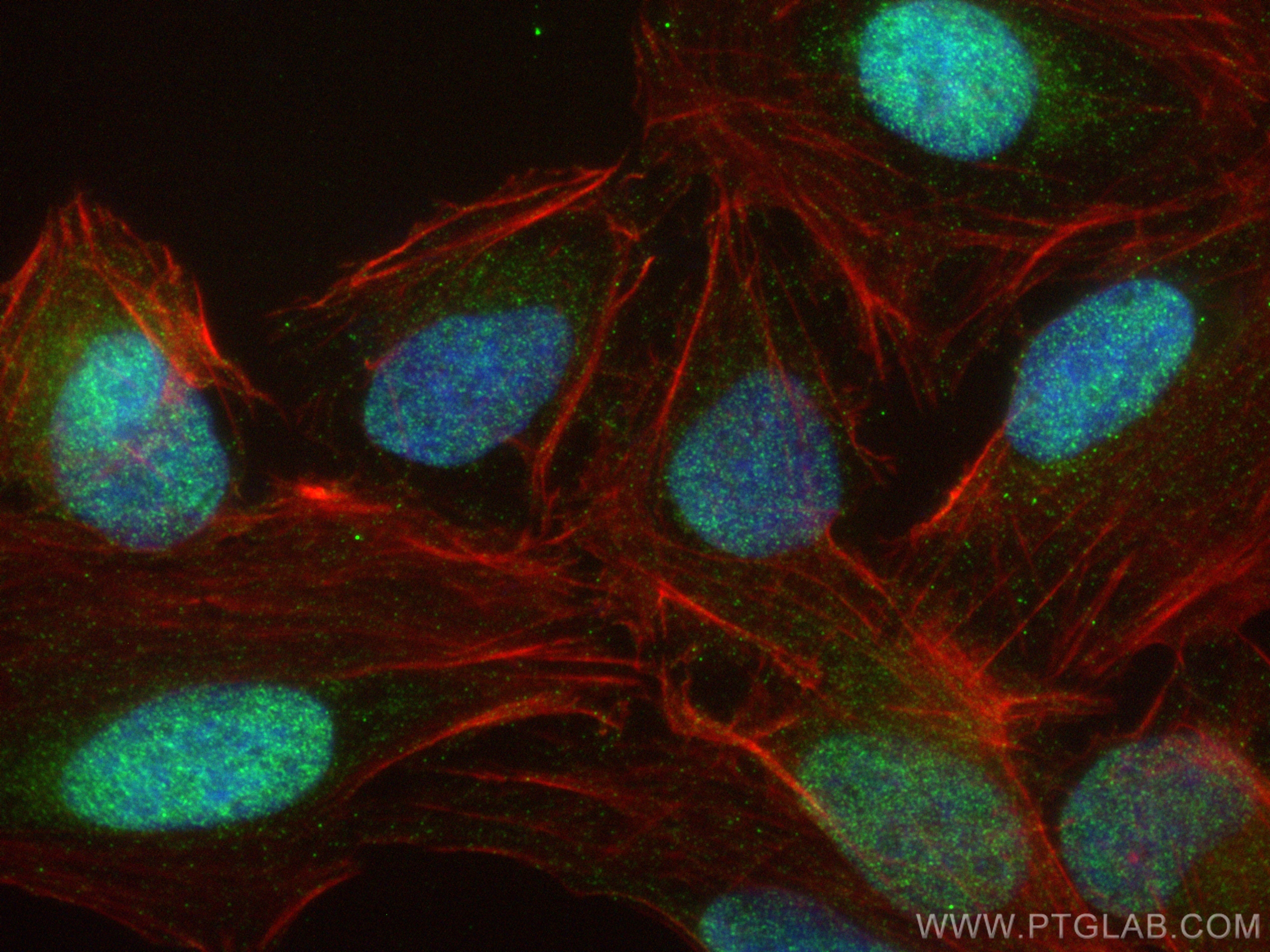 IF Staining of U2OS using 27707-1-AP