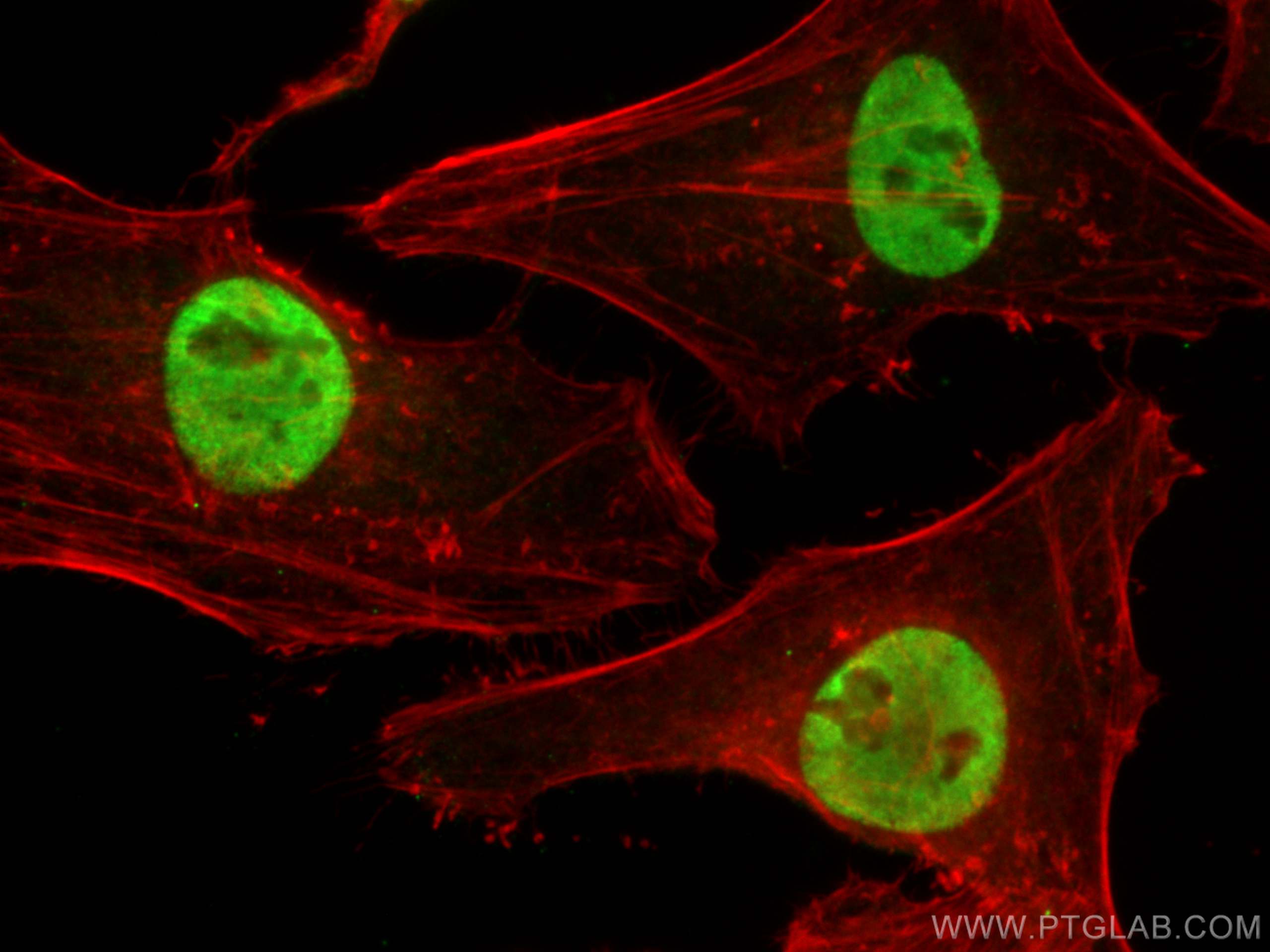 IF Staining of HeLa using 24864-1-AP