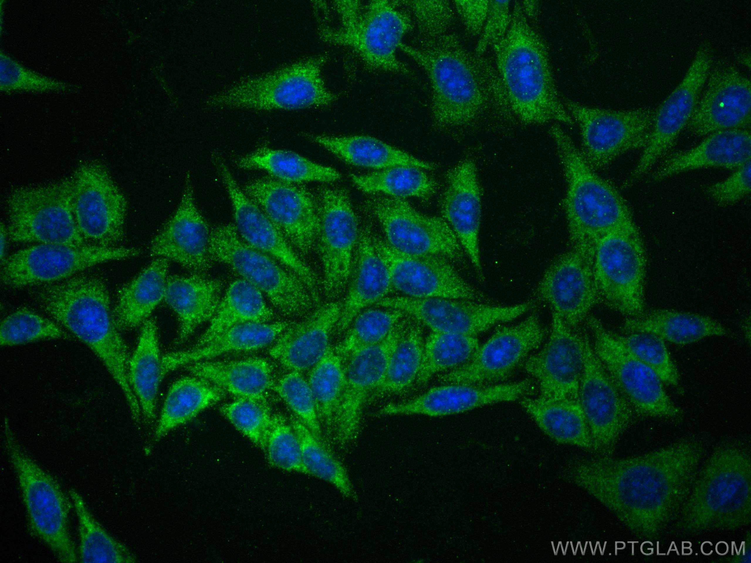 IF Staining of HepG2 using 67251-1-Ig (same clone as 67251-1-PBS)