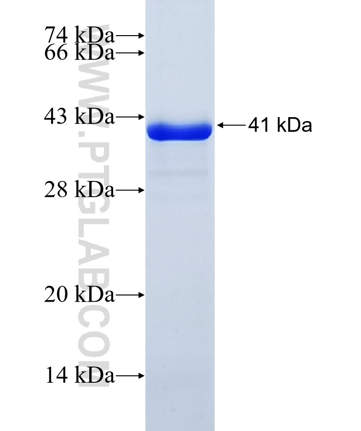 FUCA1 fusion protein Ag9638 SDS-PAGE