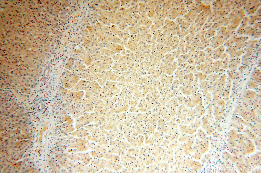 IHC staining of human liver using 15157-1-AP