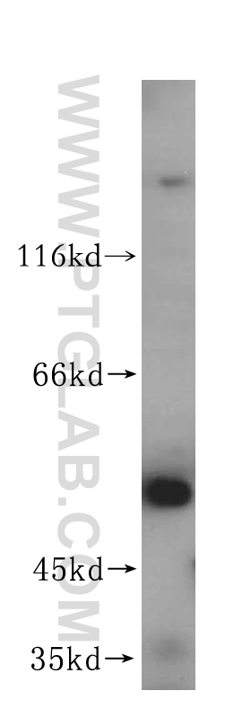 WB analysis of human heart using 15157-1-AP