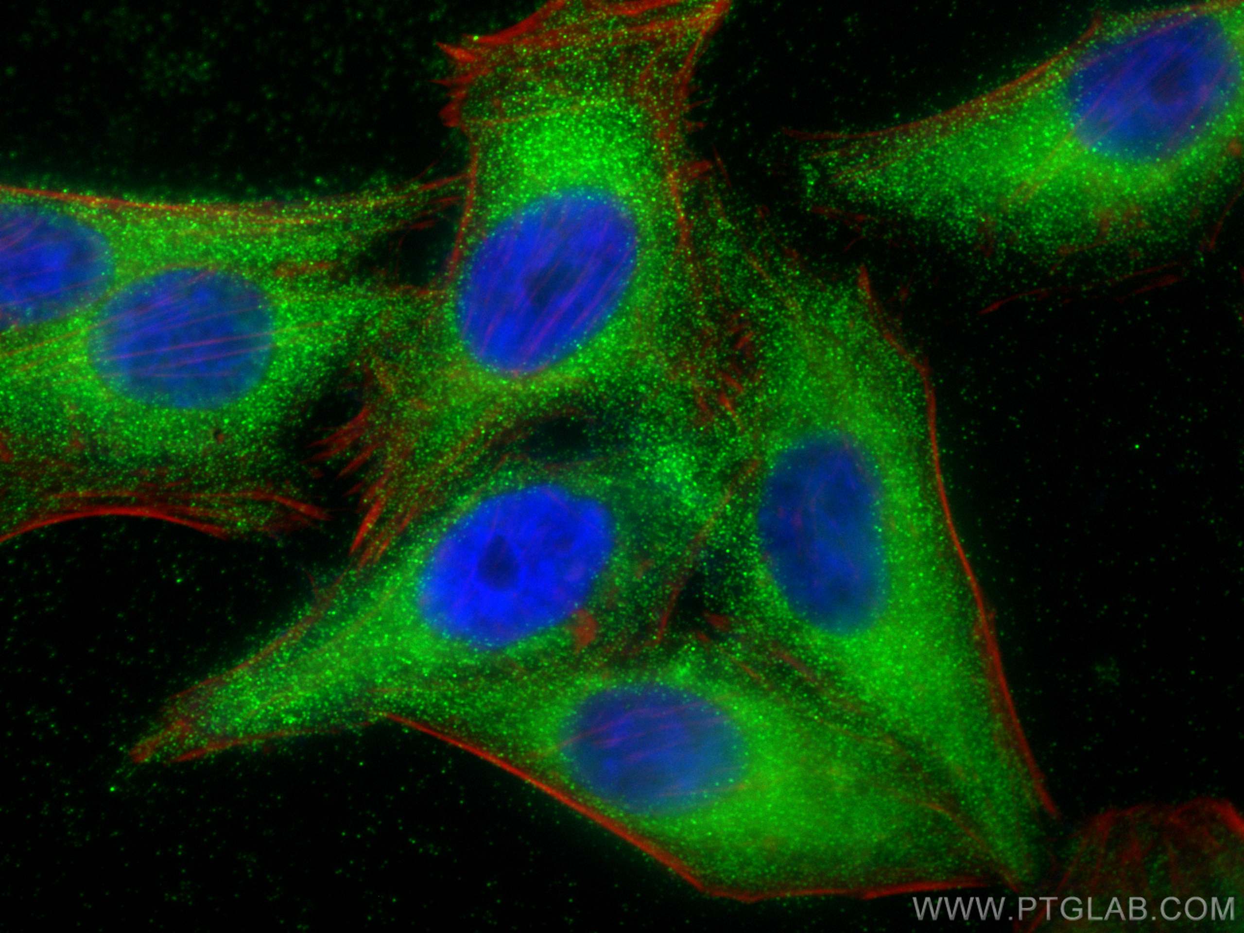 IF Staining of HepG2 using 30080-1-AP