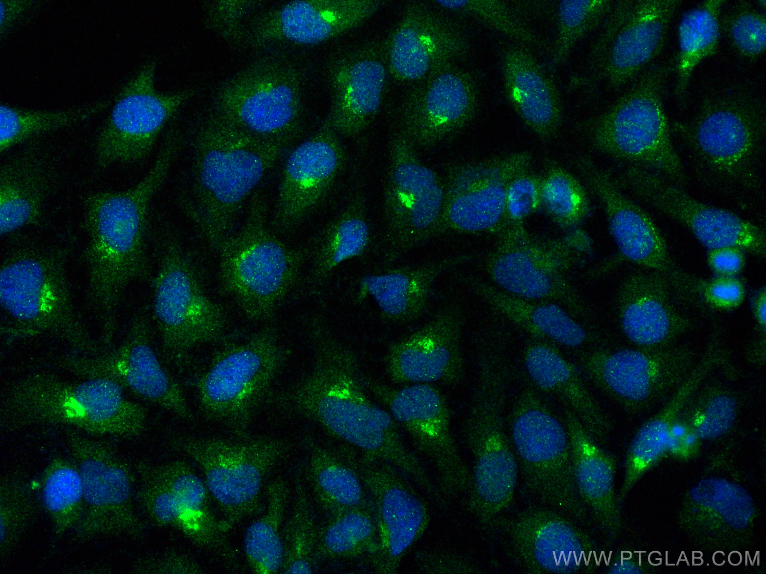 IF Staining of HeLa using 18413-1-AP