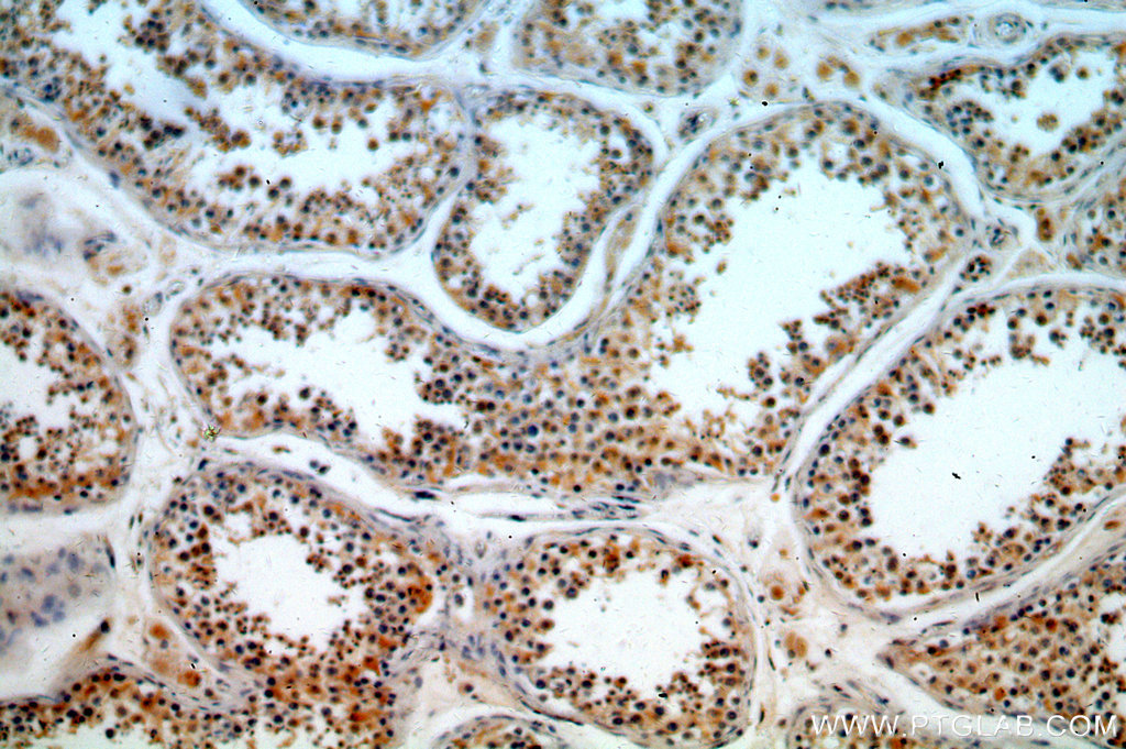 IHC staining of human testis using 18660-1-AP