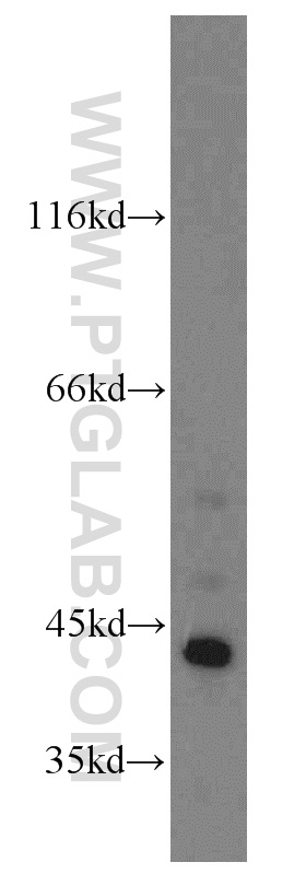 WB analysis of HeLa using 18660-1-AP