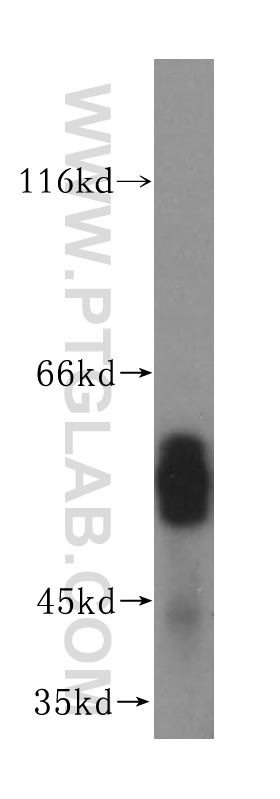 WB analysis of mouse lung using 17175-1-AP