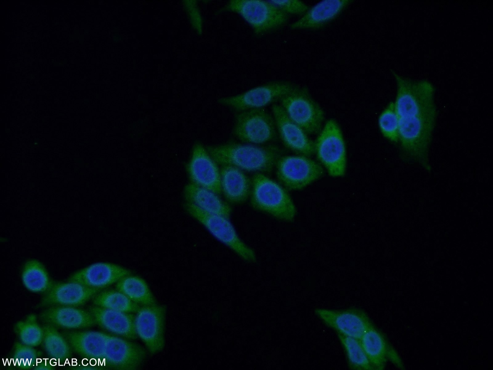 IF Staining of HeLa using 18197-1-AP