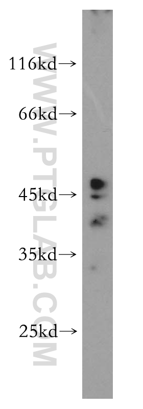 WB analysis of HeLa using 18197-1-AP