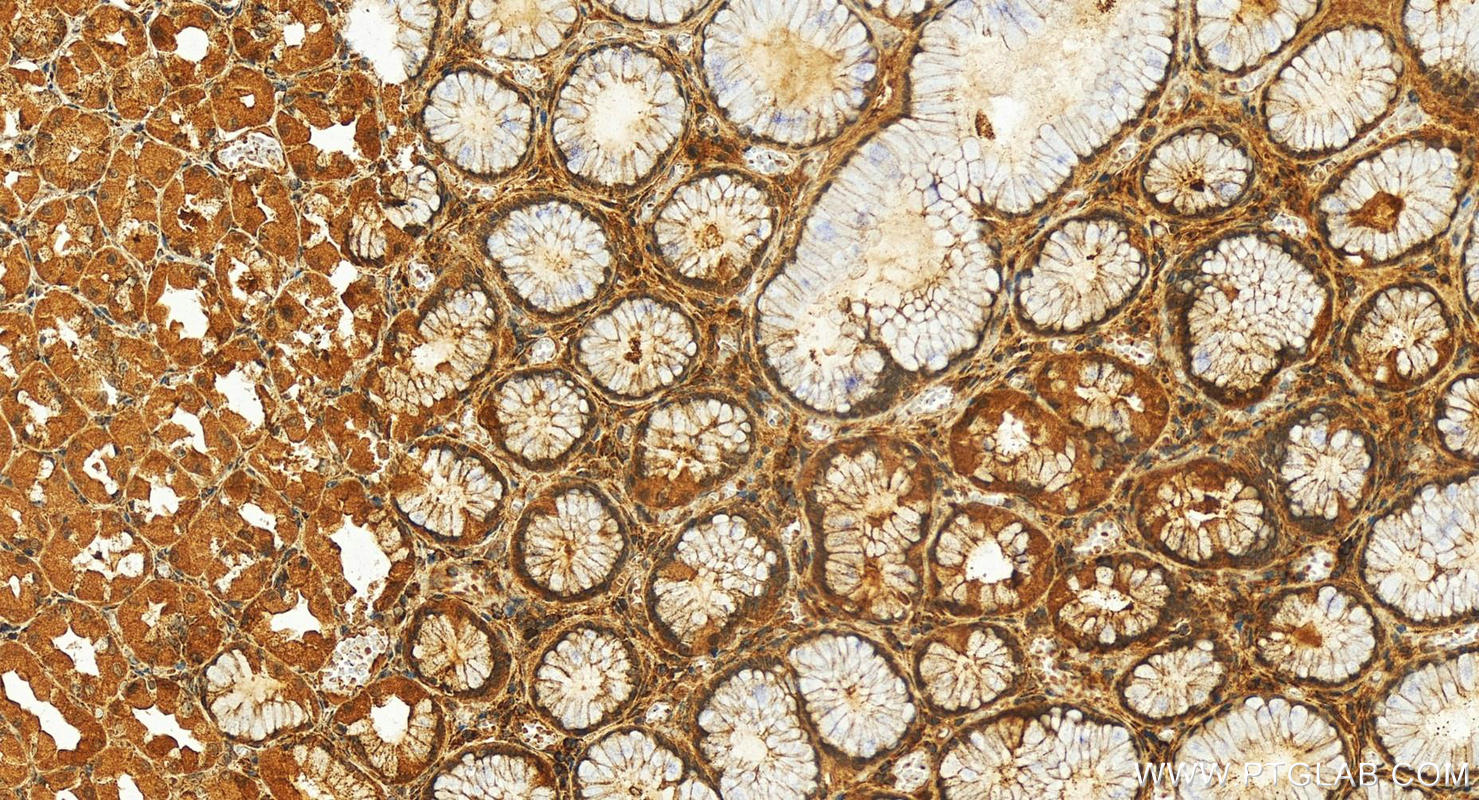 IHC staining of human stomach using 14147-1-AP