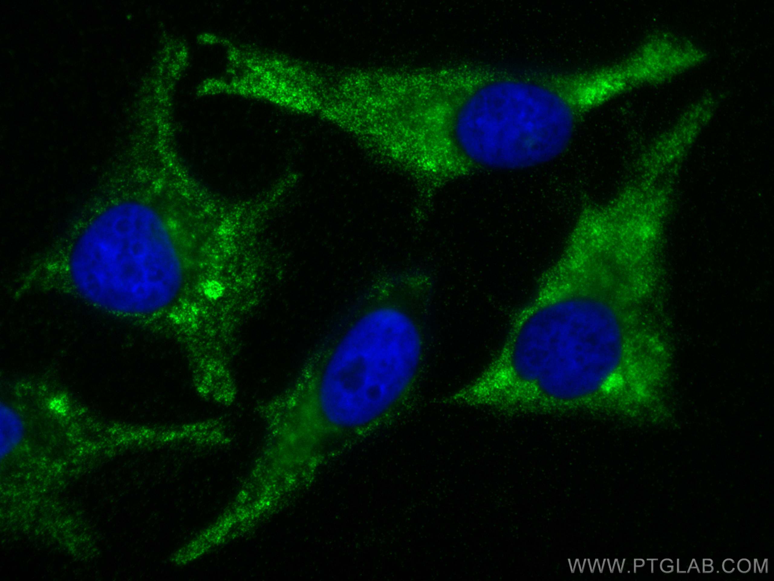 IF Staining of HeLa using 13194-1-AP