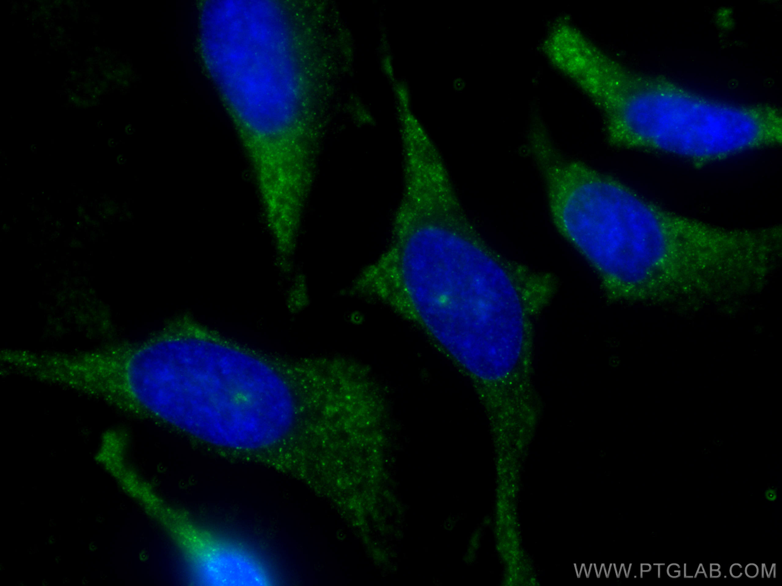 IF Staining of HeLa using 67813-1-Ig