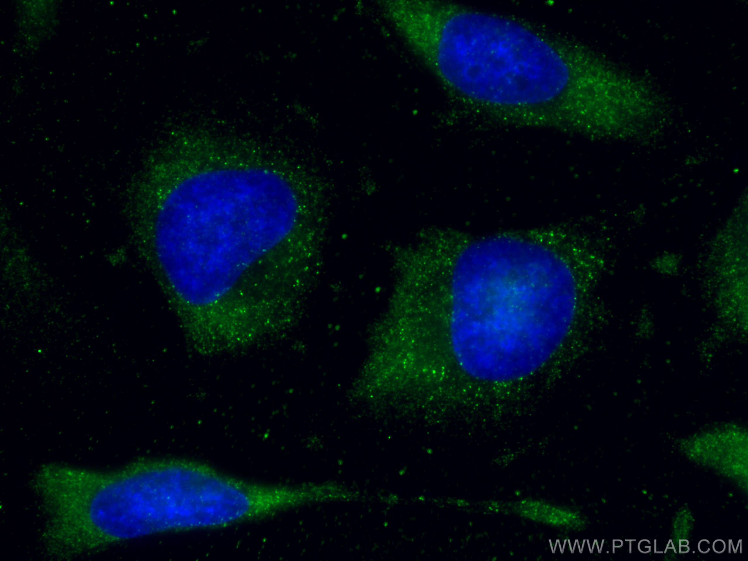 IF Staining of HeLa using 67813-1-Ig