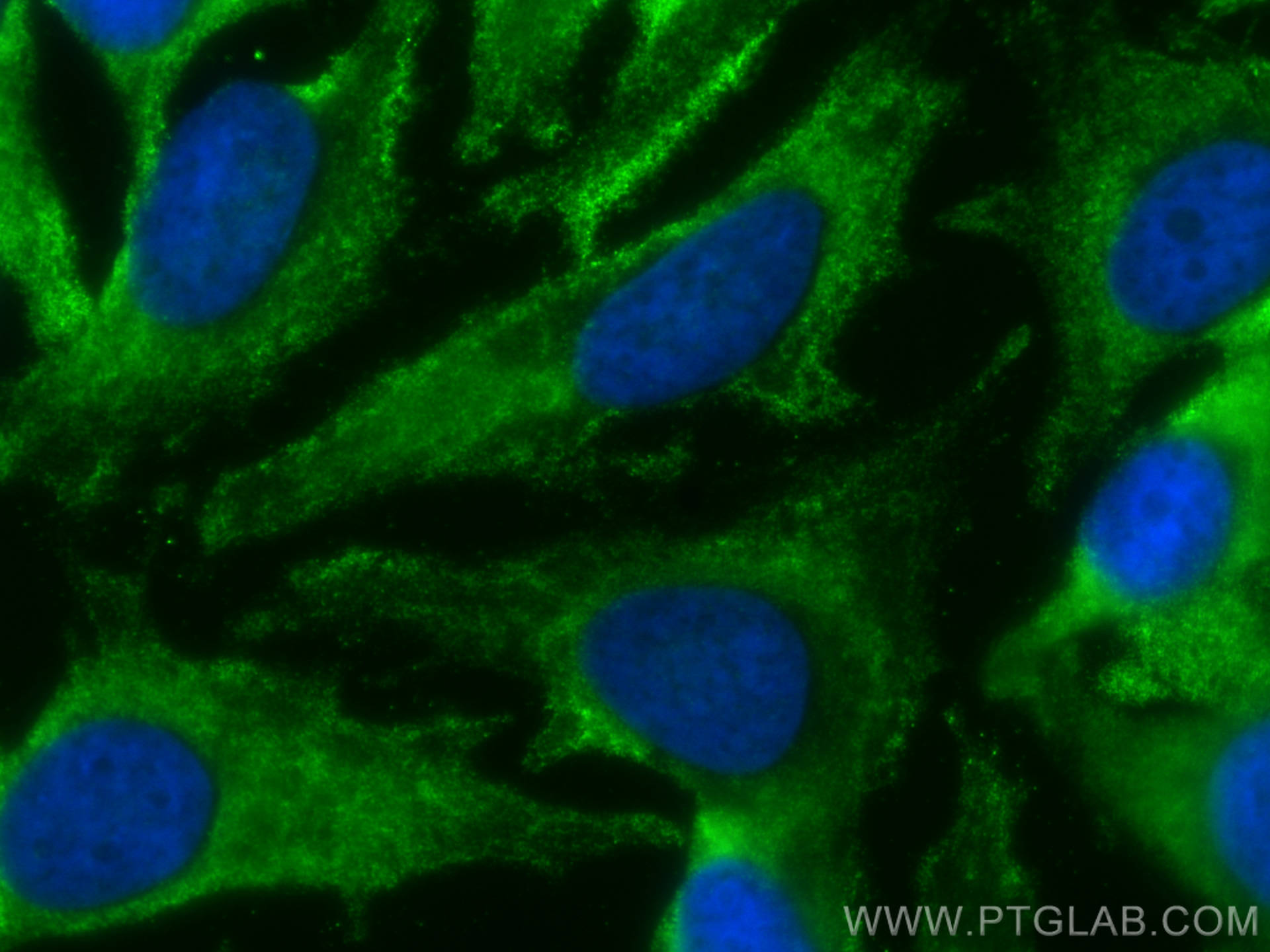 IF Staining of HeLa using CL488-67813