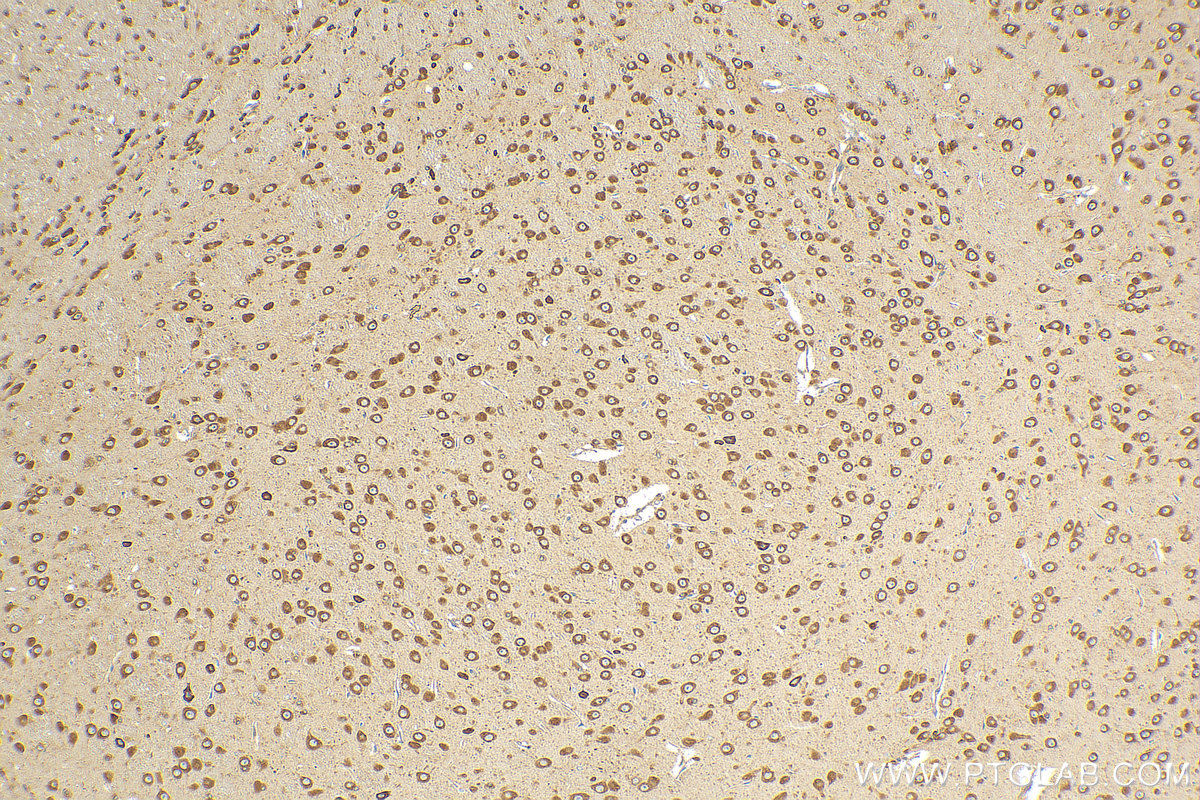 IHC staining of mouse brain using 12552-1-AP