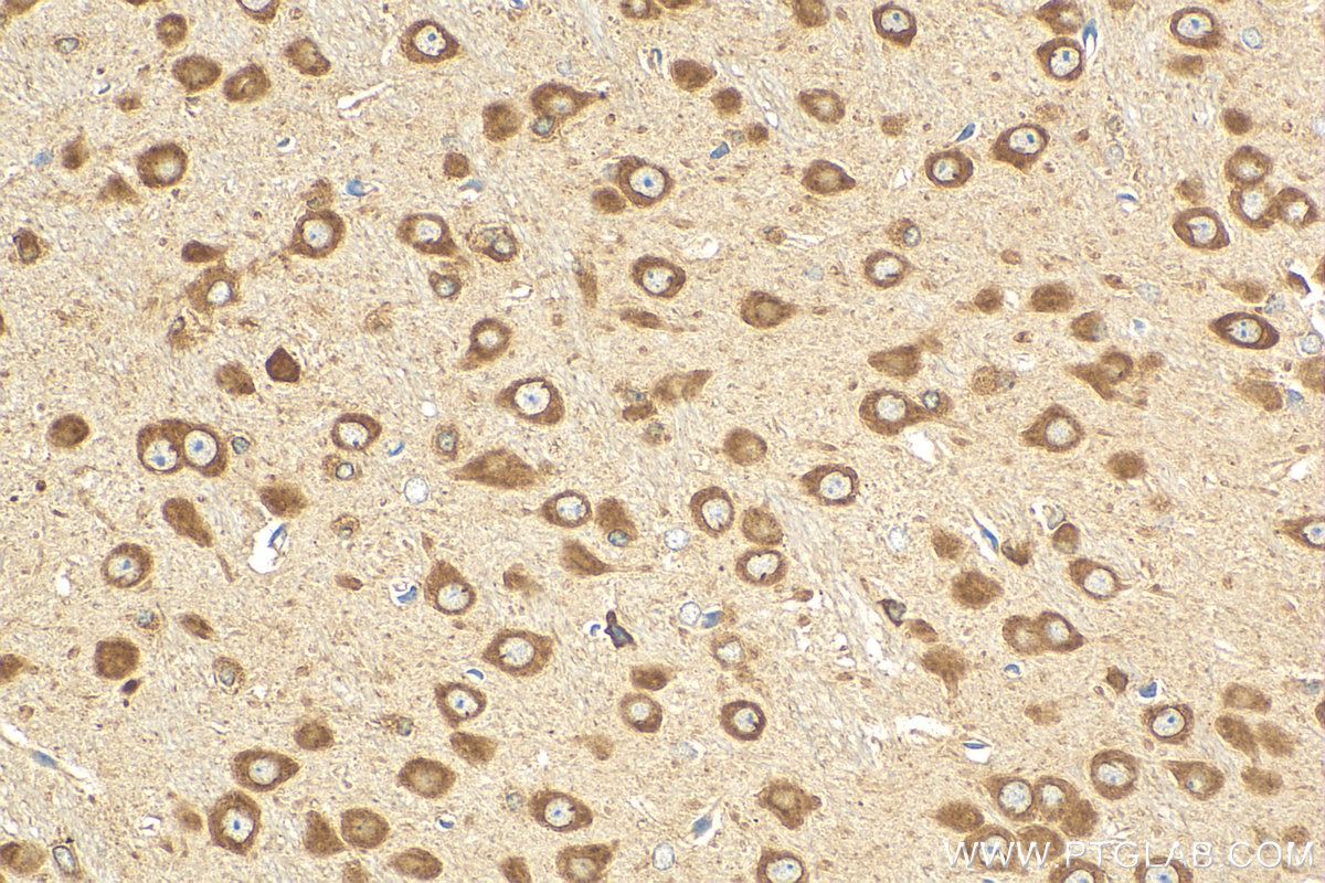 IHC staining of mouse brain using 12552-1-AP