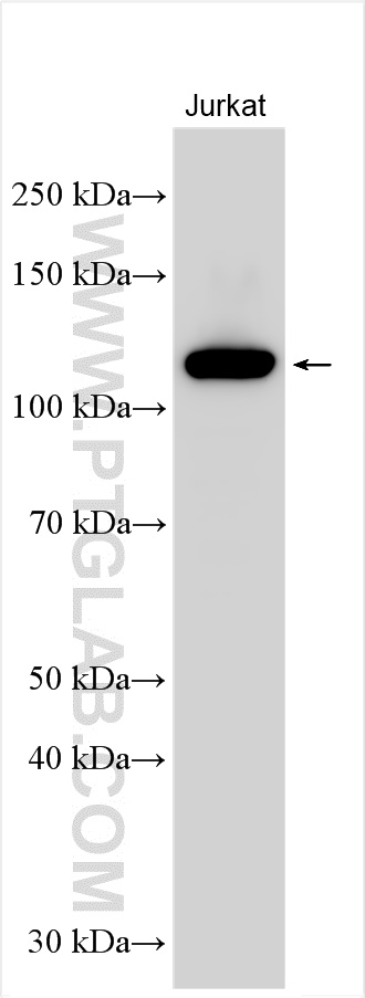 WB analysis using 31553-1-AP