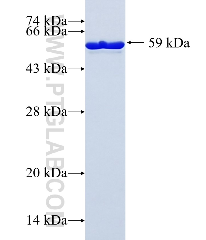 FYB fusion protein Ag35929 SDS-PAGE