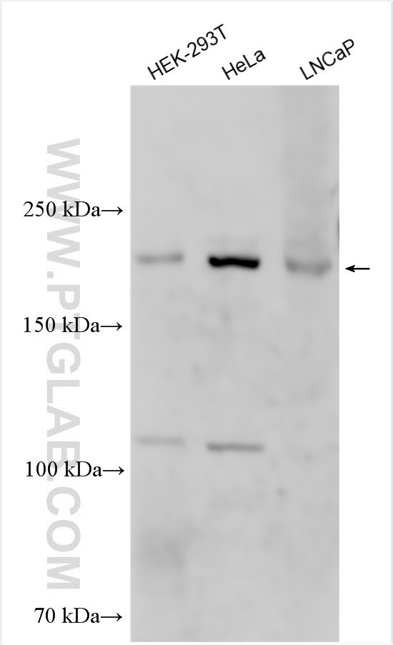 WB analysis using 25730-1-AP