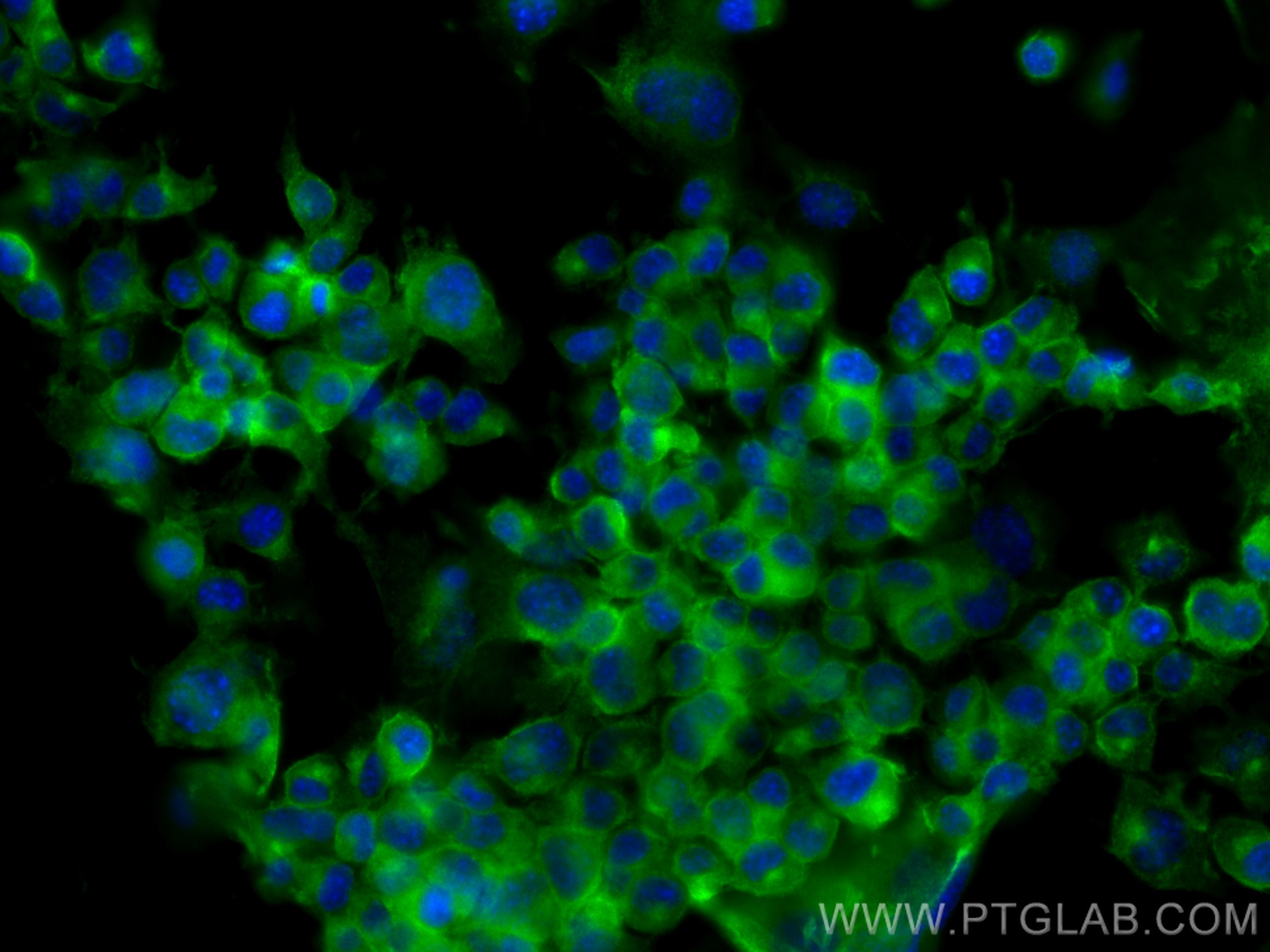 IF Staining of Neuro-2a using 66606-1-Ig (same clone as 66606-1-PBS)