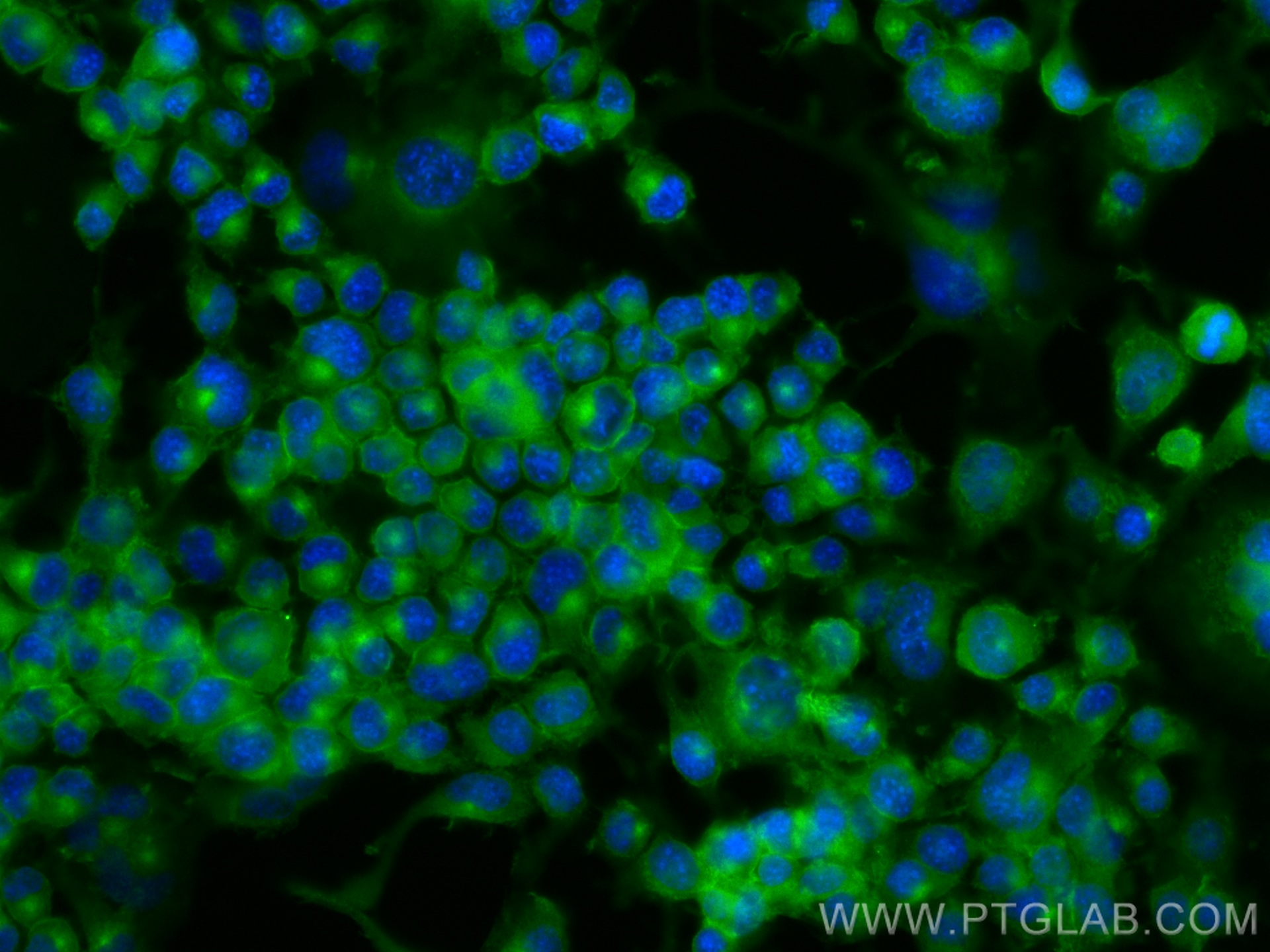 IF Staining of Neuro-2a using CL488-66606