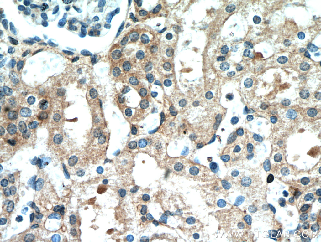 IHC staining of human kidney using 18175-1-AP