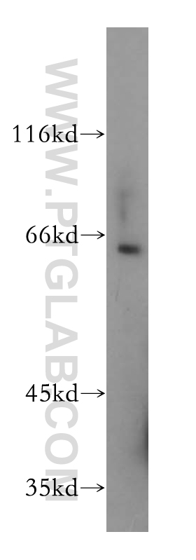 WB analysis of mouse kidney using 18175-1-AP