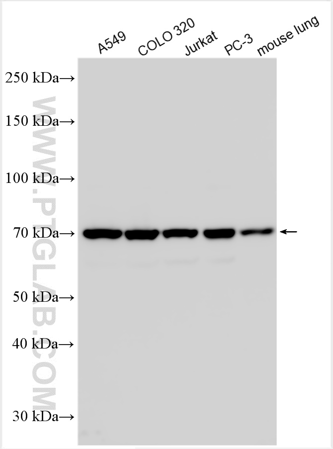 WB analysis using 21519-1-AP