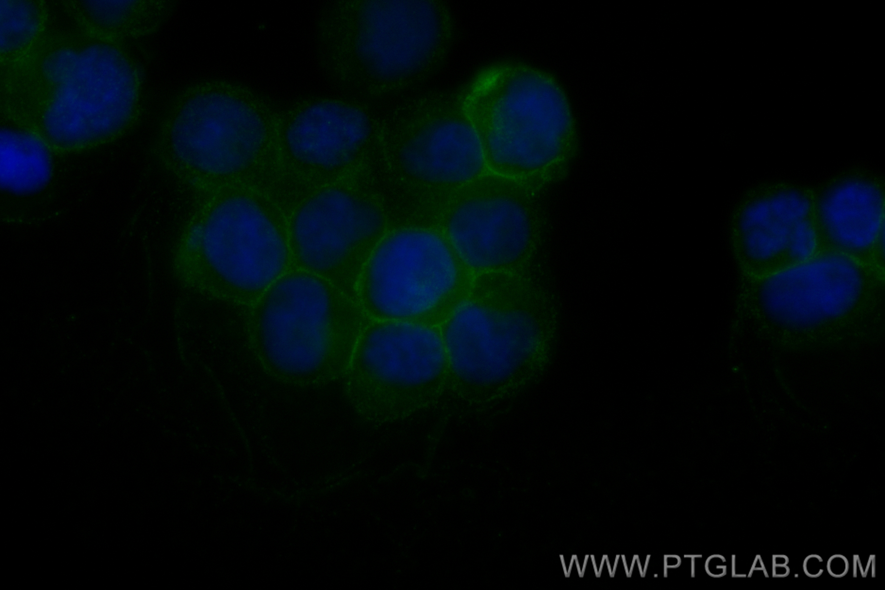 IF Staining of Jurkat using CL488-83400-5